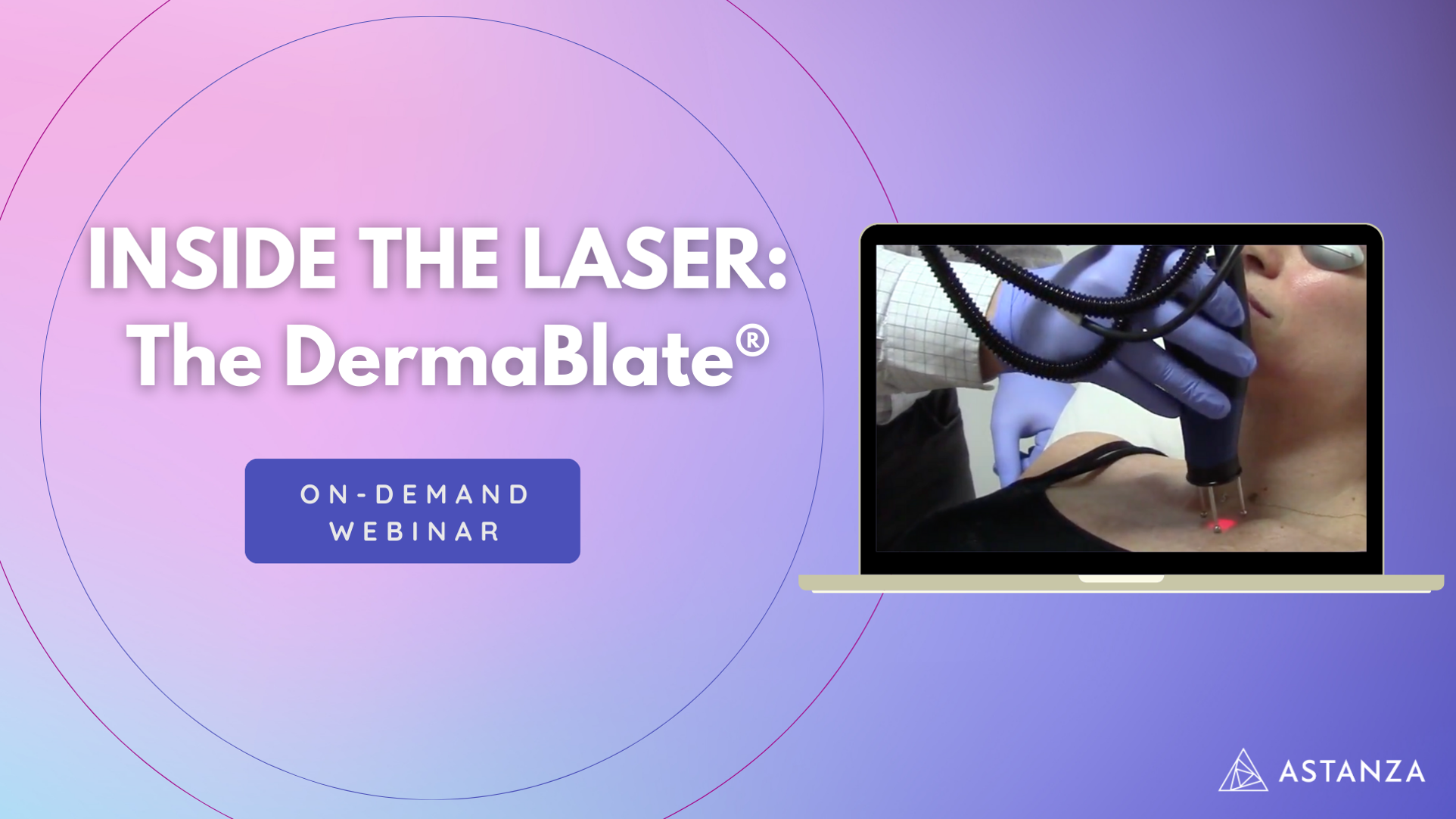 on demand webinar hosted by astanza laser titled inside the laser the dermablate walks through the powerful erbium YAG laser device